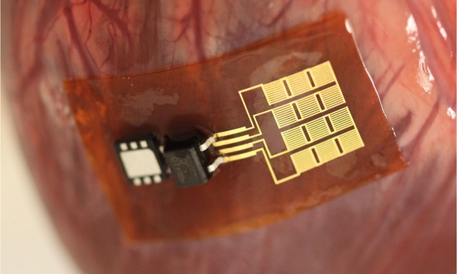 John A.Rogers的研發團隊已將研發的壓電能量採集裝置用於牛、羊、豬的心臟測試。