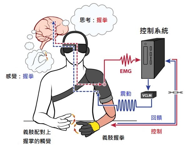 任職於著名的醫療機構—克利夫蘭診所（Cleveland Clinic）的生物工程師Paul Marasco及其研究團隊建立的義肢設計系統。穿戴者可以傳遞動作指令至義肢手臂（紅線），也可以接收義肢手臂所感測到的訊號（藍線）。（source：spectrum.ieee.org）