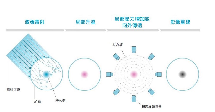 運用光聲原理，當光波撞擊組織時，吸收光的分子會因為熱能而膨脹鬆弛，這些振動會產生壓力波，進而受到偵測並重建成醫療影像。